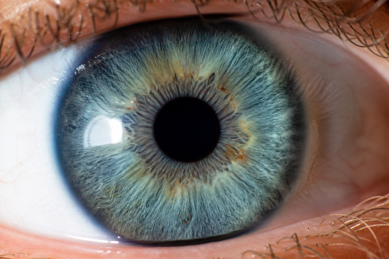Cornea and keratoconus care